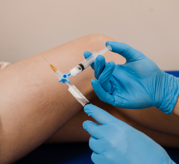 Sclerotherapy for Leg Veins